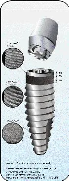  Zincosite -  Niezawodny Materiał dla Implantów i Regeneracji Kości?